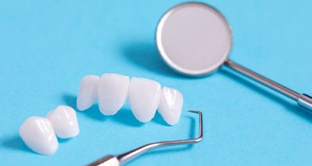 Two different dental bridges next to dental tools