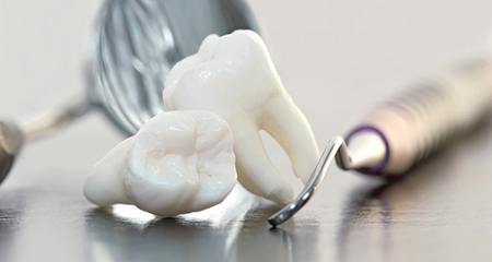 Two extracted teeth next to dental tools